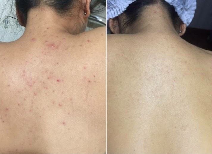 نتيجة استعمال TudaTallow الأولى
